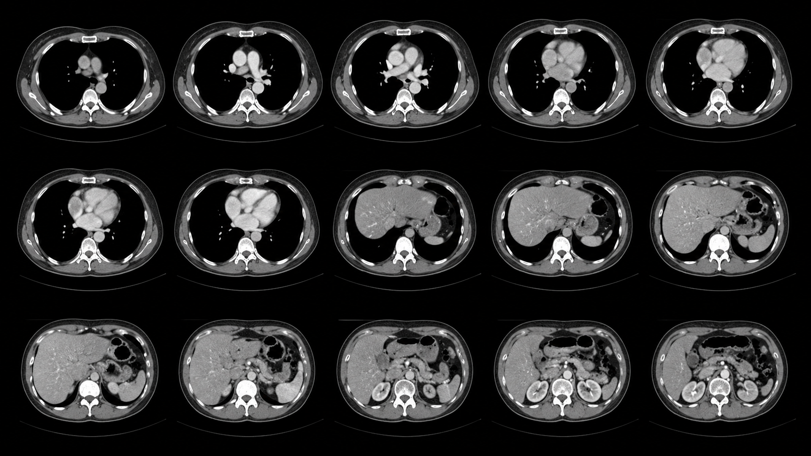 Multi-slice CT study